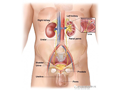 前列腺和腎癌的局部治療